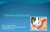 06 - Cáncer Gastrico