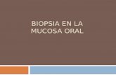 Biopsia en La Mucosa Oral