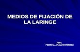 Medios de Fijacion de La Laringe -> Futura Médica