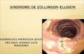 Sindrome de Zollinger-ellison