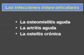 1- Osteomielitis agudas