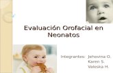 Evaluacin Orofacial en Neonatos2003