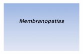 Presentación viernes membranopatias