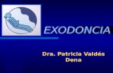 Concepto de exodoncia