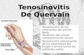 Tenosinovitis  De Quervain