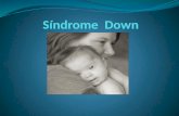 Sindrome Down Presentacion
