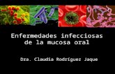 Enfermedades Infecciosas de La Mucosa Oral 1