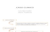 Caso Clinico Neurologia Acv Isquemico