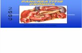 Pancreatitis Cronica
