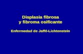 15- Displasia fibrosa