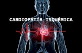 cardiopatia isquemica