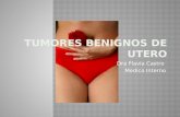 Tumores Benignos de Utero