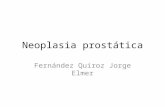 Neoplasia prostática