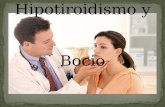 Hipotiroidismo Walter 1
