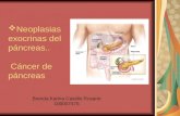Neoplasias exocrinas del páncreas (1)2