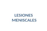 LESIONES  MENISCOS 3