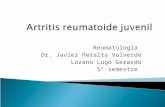 Artritis reumatoide juvenil