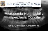 Microsomia Hemifacial y Hiperplasia Condilar christian patron roman