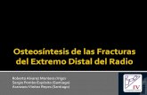 Osteosintesis Fracturas Extremo Distal Del Radio