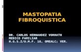 MASTOPATIA FIBROQUISTICA