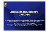 Agenesia Cuerpo Calloso