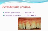 Periodontitis cronica