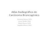 Atlas radiográfico de carcinoma broncogenico