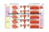 Sangrado uterino abnormal