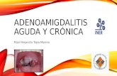 Adenoamigdalitis aguda y crónica