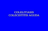 Colelitiasis Cistitis