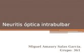 Neuritis óptica intrabulbar