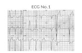 Clase repaso de electrocardiograma con vistas al segundo parcial