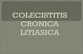 Colecistitis cronica litiasica