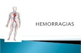 HEMORRAGIAS - PRIMEROS AUXILIOS