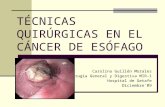 Técnicas quirúrgicas en el cáncer de esófago