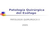 Patología quirúrgica del esófago