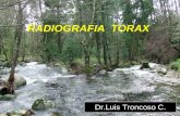 RADIOGRAFIA  DE  TORAX Dr.Luis  Troncoso Castro