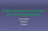 Enfermedades producidas por microorganismos