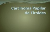 Carcinoma papilar de tiroides