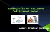 Radiografía en pacientes politraumatizados