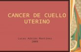 Cancer de cuello_uterino[1]
