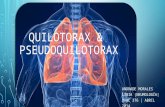 Quilotorax &  pseudoquilotorax