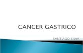 Cirugia cancer-gastrico