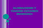 9 ulceraciones y tumores cutaneos beningnos