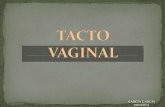 23275002 tacto-vaginal