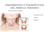 Nodulo tiroides