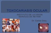 Toxocariasis ocular