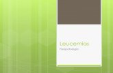 Leucemias 110626185935-phpapp02