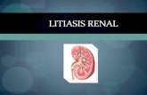 Litiasis renal también denominada urolitiasis
