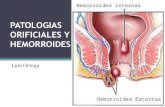 Hemorroides y otras patologias orificiales